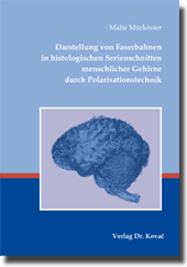 Darstellung von Faserbahnen in histologischen Serienschnitten menschlicher Gehirne durch Polarisationstechnik (Dissertation)